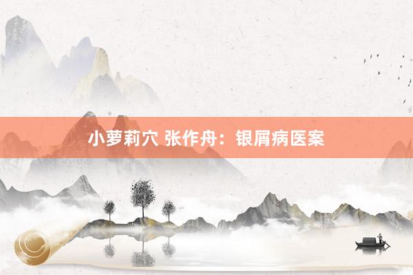 小萝莉穴 张作舟：银屑病医案