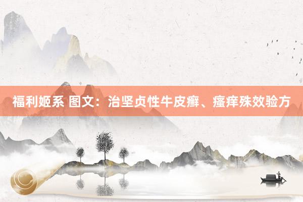 福利姬系 图文：治坚贞性牛皮癣、瘙痒殊效验方